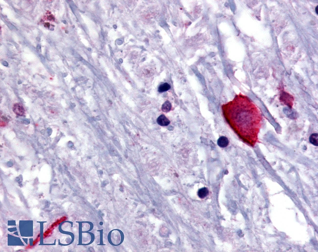 IHC-plus™ BRS3 Antibody (N-Terminus)