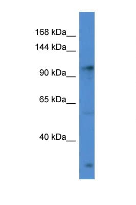 GABBR2 / GABA B Receptor 2 Antibody (aa761-810)