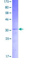 Human IAPP / Amylin Protein (Recombinant GST)