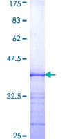 Human AHR Protein (Recombinant GST, N-terminus)