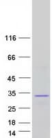 Human FGF19 Protein (Recombinant Myc-DDK (Flag))