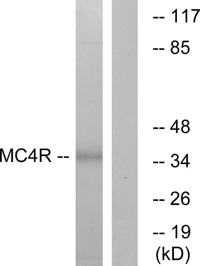 MC4R / Melanocortin 4 Receptor Antibody (aa281-330)