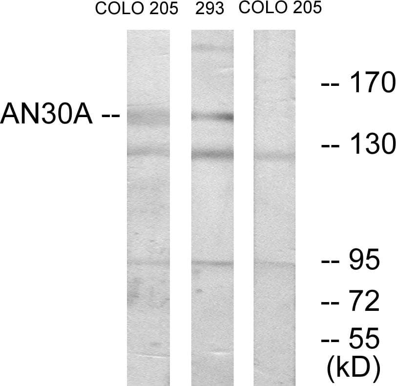 ANKRD30A / NY-BR-1 Antibody