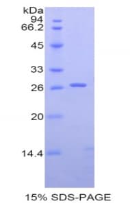 Human CD22 Protein (Recombinant His)