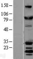 DNM1L / DRP1 Protein (Over-Expression Lysate Myc-DDK (Flag))