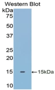 TXN / Thioredoxin / TRX Antibody (aa1-105)