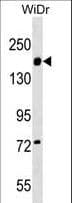 ITGA2 / CD49b Antibody (aa1152-1180)