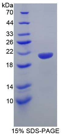 Mouse SMARCA3 / HLTF Protein (Recombinant His-T7)