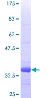 Human PTX3 / Pentraxin 3 Protein (Recombinant GST, N-terminus)