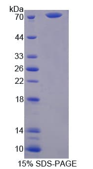 Human SERPINA10 / PZI Protein (Recombinant His-GST)
