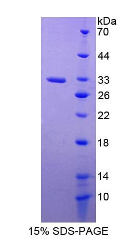 Mouse PPT1 / CLN1 Protein (Recombinant His-T7)