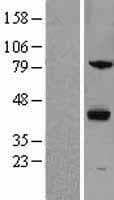 ZPBP / SP38 Protein (Over-Expression Lysate Myc-DDK (Flag))