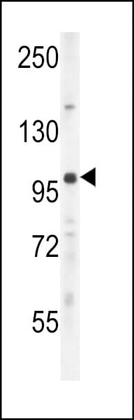 UNK Antibody (aa224-253)