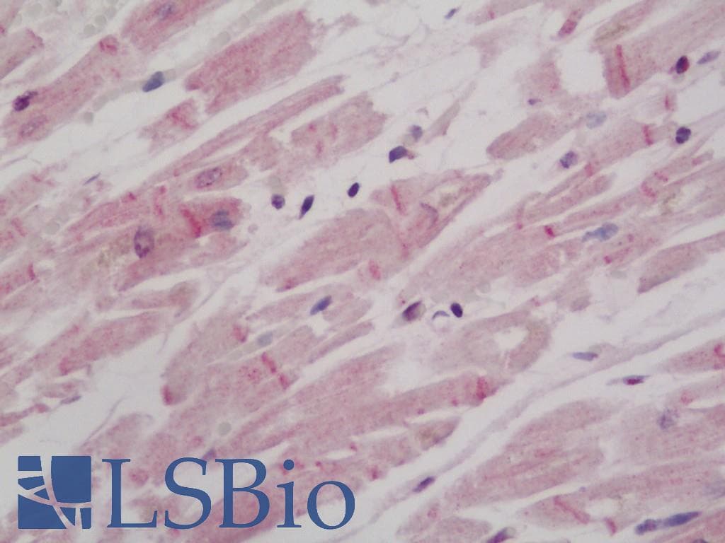IHC-plus™ Polyclonal Rabbit anti-Human BAMBI Antibody (IHC, IF, WB)