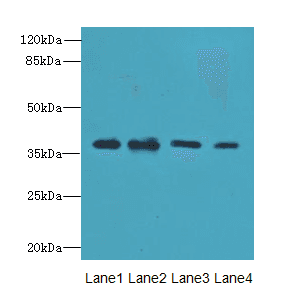 Polyclonal Rabbit anti-Human RIBC2 Antibody (IHC, WB)