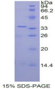 Human MAPK8 / JNK1 Protein (Recombinant His-T7)