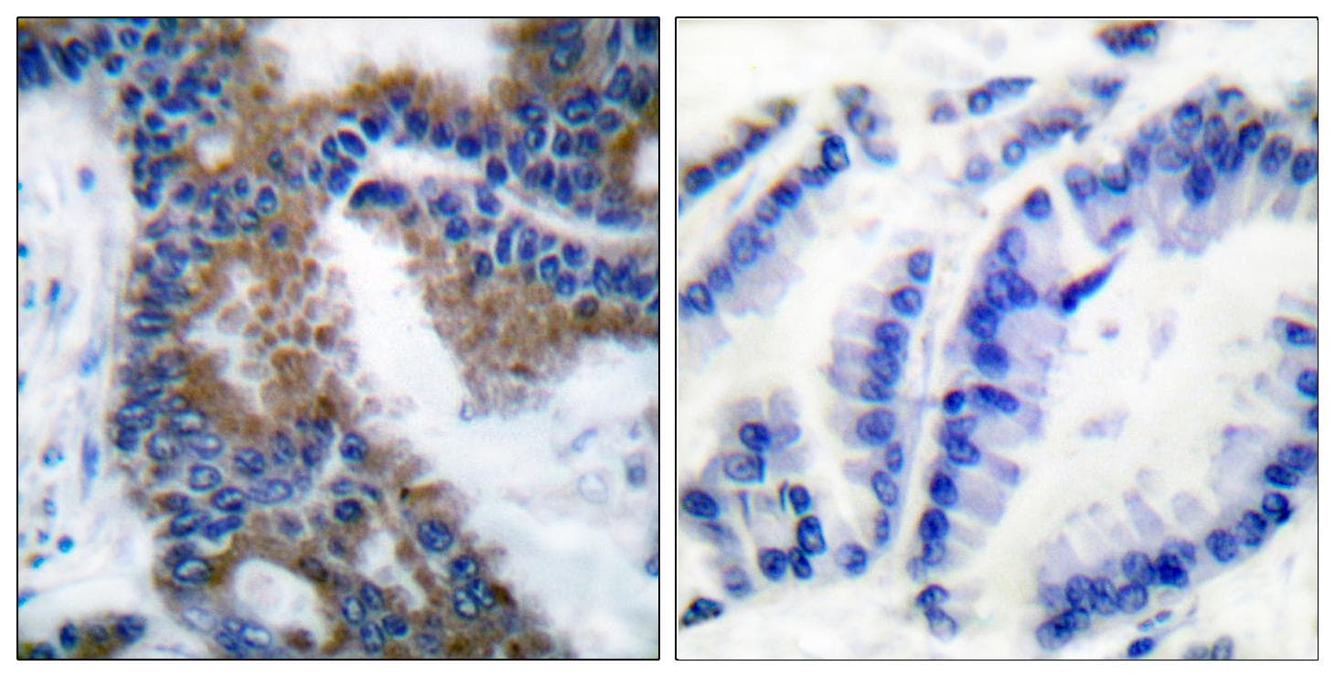 CRKL Antibody (phospho-Tyr207)