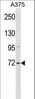 ZSWIM2 Antibody (aa435-462)