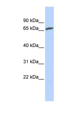Polyclonal Rabbit anti-Human CRD-BP / ZBP1 / IGF2BP1 Antibody (aa40-90, WB)