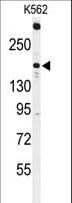 TNK2 / ACK1 Antibody (aa10-39)