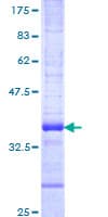 Human RNF26 Protein (Recombinant GST, N-terminus)