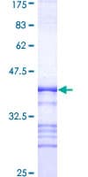Human PAK2 Protein (Recombinant GST, N-terminus)