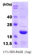 Human FTL / Ferritin Light Chain Protein (Recombinant)