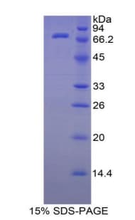 Human HSPA1L Protein (Recombinant His-S)