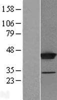 THUMPD1 Protein (Over-Expression Lysate Myc-DDK (Flag))
