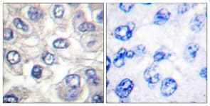 BAD Antibody (aa21-70)