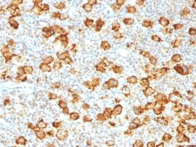 CD30 Antibody (clone Ki-1/1505R, Azide-free, Carrier-free)