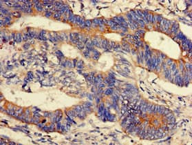 PPM1K Antibody