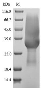 Rat USAG1 / SOSTDC1 Protein (Recombinant 6His-SUMOstar, N-terminus)