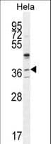 SELV Antibody (aa296-324)