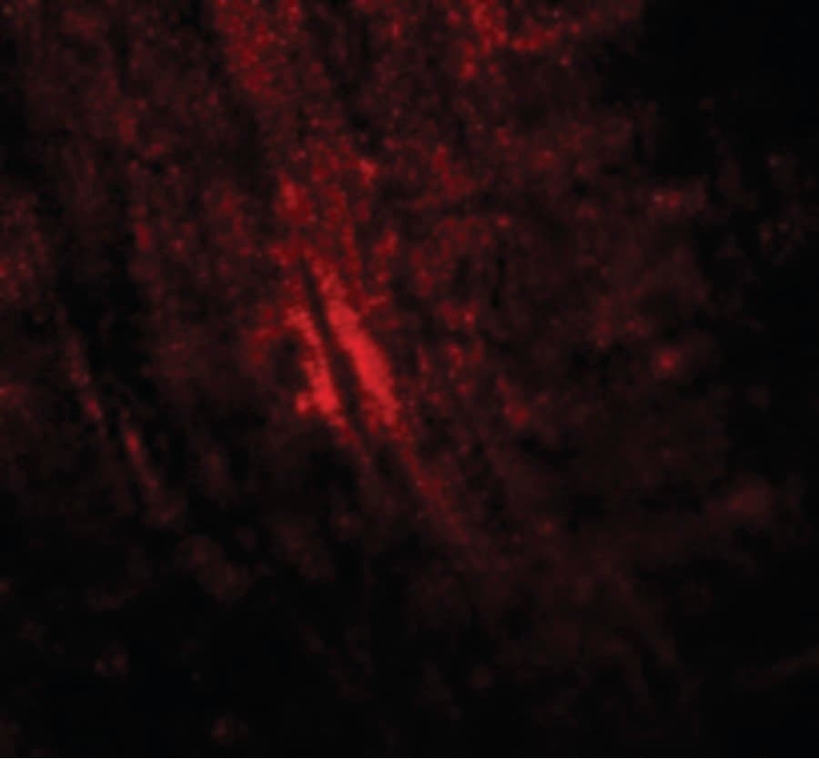 Polyclonal Rabbit anti-Human MYBPC1 Antibody (IF, WB)