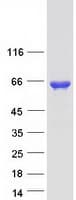 Human HNRNPK / hnRNP K Protein (Recombinant Myc-DDK (Flag))