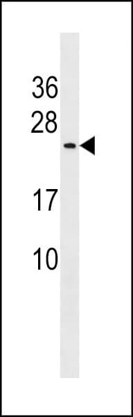 CUTA Antibody (aa116-144)