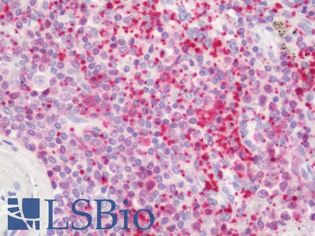 IHC-plus™ RIP1 / RALBP1 Antibody (clone 1H9)