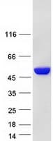 Human G6PD Protein (Recombinant Myc-DDK (Flag))