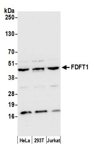 Polyclonal Rabbit anti-Human FDFT1 / Squalene Synthase Antibody (aa367-417, WB)