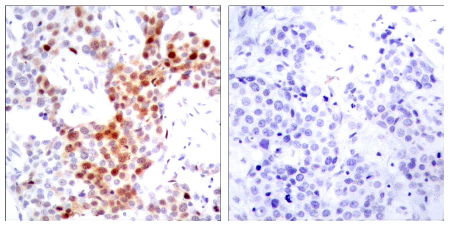 Polyclonal Rabbit anti-Human ATF2 Antibody (phospho-Thr69/Thr51, IHC, WB)