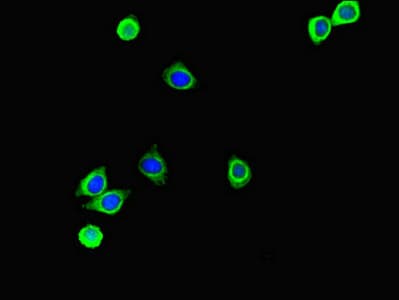 S100P Antibody