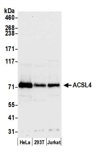 Polyclonal Rabbit anti-Human ACSL4 / FACL4 Antibody (aa250-300, WB)