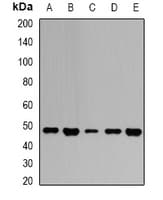Polyclonal Rabbit anti-Human GOT2 Antibody (IHC, WB)