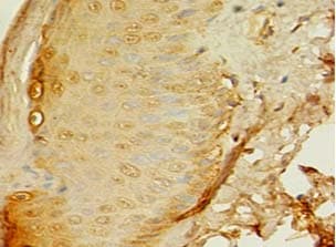 Polyclonal Rabbit anti-Human APAF1 / APAF-1 Antibody (IHC)