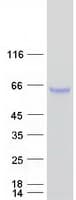 Human Alpha-Fetoprotein (Recombinant Myc-DDK (Flag))