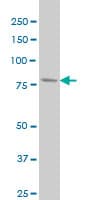 Monoclonal Mouse anti-Human PFKL Antibody (clone 2A9, WB)