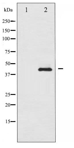SMAD3 Antibody (phospho-Ser208)