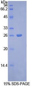 Rat GJA1 / CX43 / Connexin 43 Protein (Recombinant His, N-Terminal)