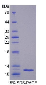 Human REG3G Protein (Recombinant His-T7)